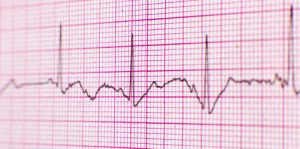 Electrocardiogram